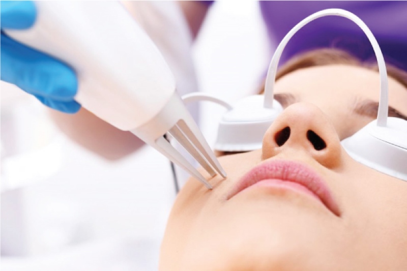Sử Dụng Máy Laser Picosure Mini An Toàn và Tiết Kiệm Điện Năng