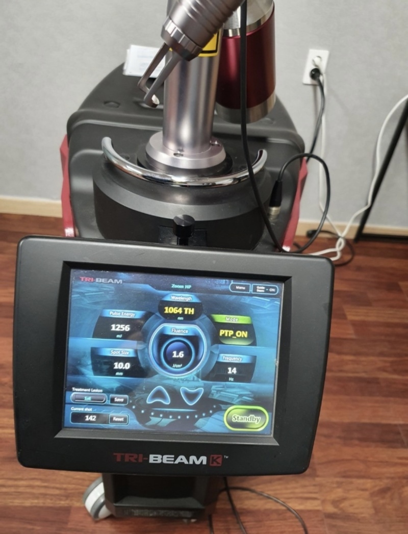 Tổng quan về máy Laser Beam K, cấu tạo và nguyên lý hoạt động cơ bản Tổng quan về máy Laser Beam K, cấu tạo và nguyên lý hoạt động cơ bản