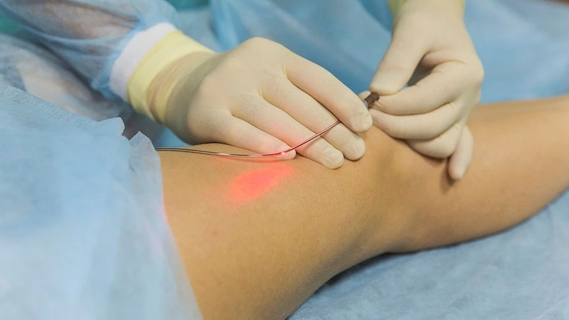 Lưu ý sử dụng máy Laser 980nm Sanhe an toàn, tiết kiệm điện