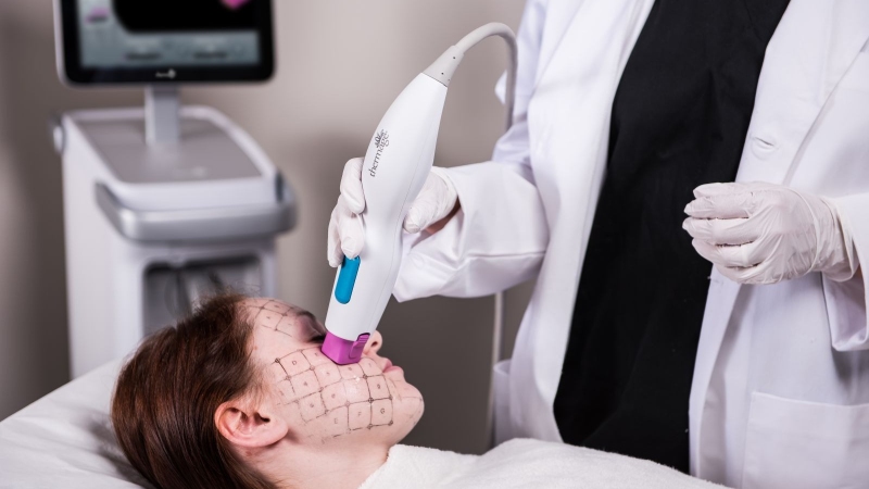 Nguyên nhân gây hỏng máy Thermage thường gặp