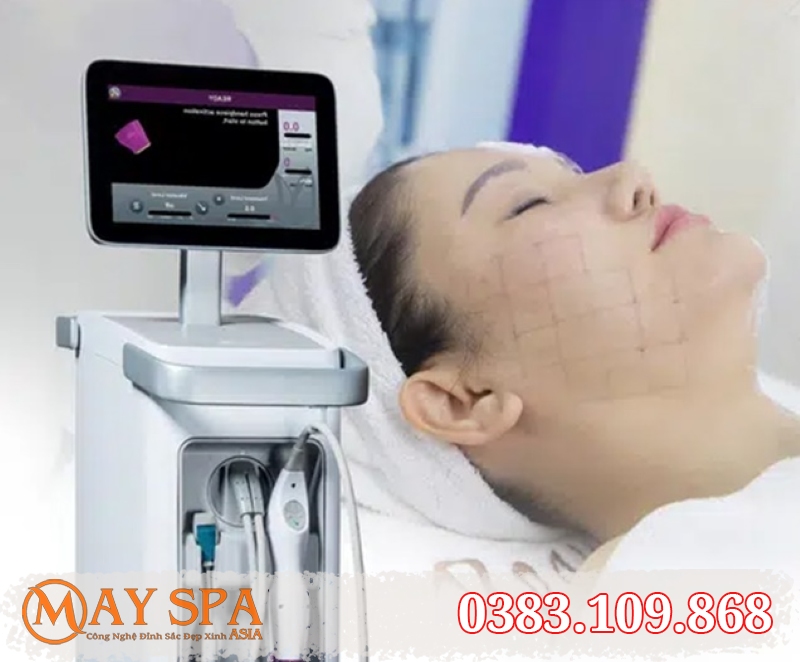 9. Câu hỏi thường gặp khi sửa máy Thermage