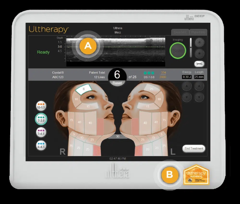 Đặc điểm nổi bật của dịch vụ sửa máy ULTherapy