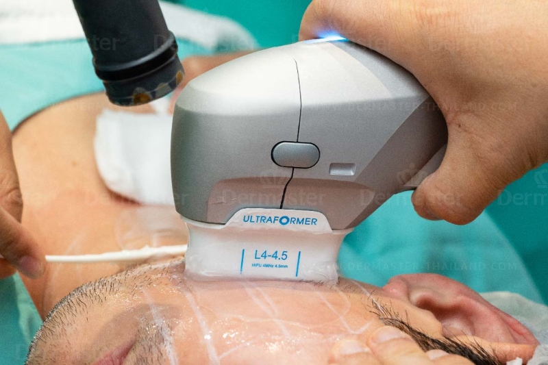 Nhận Diện Khi Nào Cần Sửa Máy ULTherapy