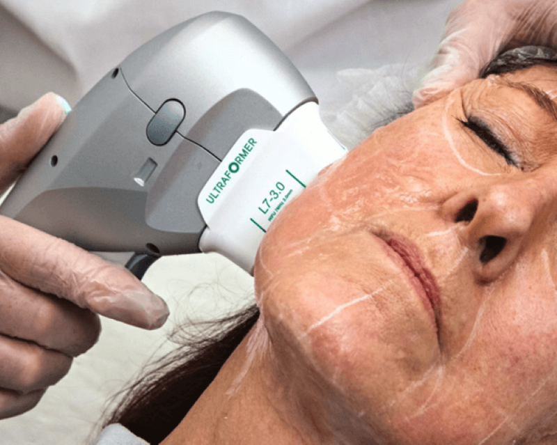 Quy Trình Sửa Chữa Máy ULTherapy Tại Máy Spa Asia