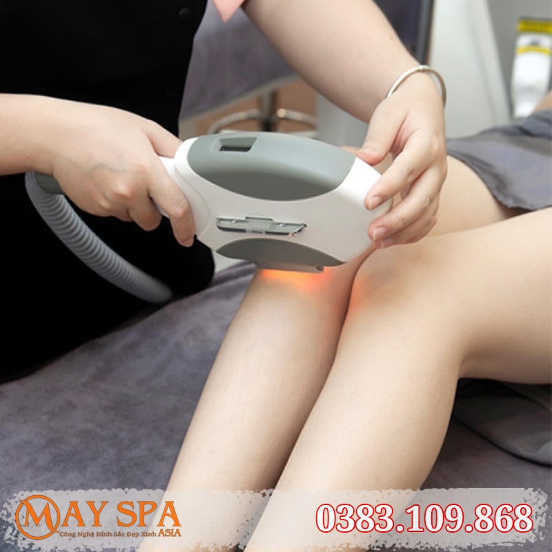 Bảng giá sửa chữa máy triệt lông lạnh tại Ba Đình (tham khảo)