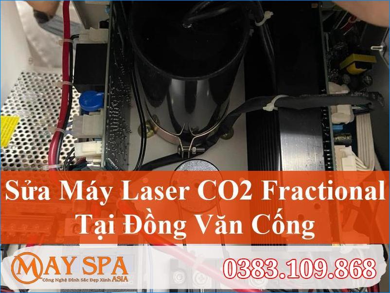 Sửa Máy Laser CO2 Fractional Đồng Văn Cống Hiệu Quả, Uy Tín